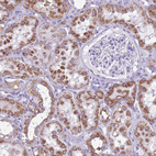 Anti-ACSS3 Antibody