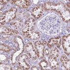 Anti-ACSS3 Antibody