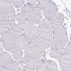 Immunohistochemical staining of human skeletal muscle shows no positivity in myocytes as expected.