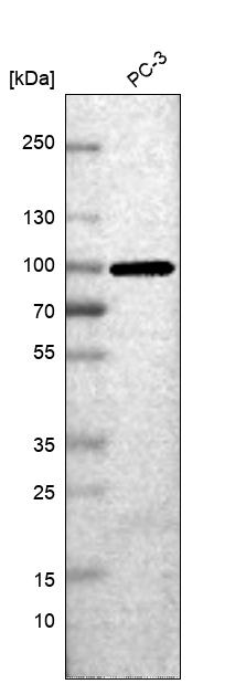 Anti-NRG2 Antibody