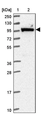 Lane 1: Marker [kDa] 250, 130, 95, 72, 55, 36, 28, 17, 10_br/_Lane 2: Human cell line RT-4