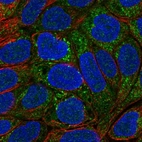 Immunofluorescent staining of human cell line RT4 shows localization to cytosol & mitochondria.