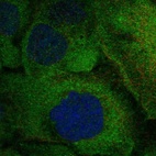 Anti-TNFRSF11A Antibody
