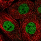Immunofluorescent staining of human cell line A-431 shows localization to nucleoplasm.