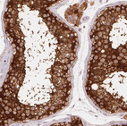 Anti-REEP6 Antibody