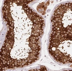 Immunohistochemical staining of human testis shows strong granular cytoplasmic positivity in cells in seminiferous ducts.