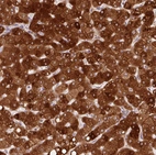 Immunohistochemical staining of human liver shows strong granular cytoplasmic positivity in hepatocytes.