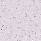 Immunohistochemical staining of human skeletal muscle shows no positivity in myocytes as expected.