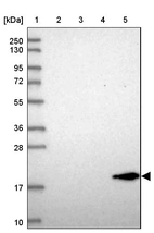 Lane 1: Marker [kDa] 250, 130, 95, 72, 55, 36, 28, 17, 10_br/_Lane 2: Human cell line RT-4_br/_Lane 3: Human cell line U-251 MG_br/_Lane 4: Human plasma_br/_Lane 5: Human Liver tissue