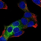 Immunofluorescent staining of human cell line Hep G2 shows localization to endoplasmic reticulum.