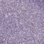 Immunohistochemical staining of human tonsil shows moderate cytoplasmic positivity in non-germinal cells.