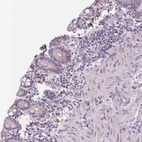 Immunohistochemical staining of human small intestine shows moderate cytoplasmic positivity in lymphoid cells.