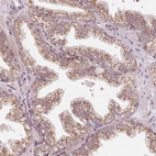 Immunohistochemical staining of human prostate shows moderate granular cytoplasmic positivity in glandular cells.