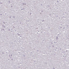 Anti-FCRL3 Antibody