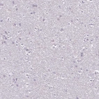 Immunohistochemical staining of human cerebral cortex shows no positivity as expected.