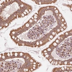 Immunohistochemical staining of human small intestine shows moderate positivity in glandular cells.