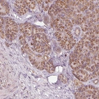 Immunohistochemical staining of human pancreas shows moderate positivity in exocrine glandular cells.