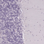Immunohistochemical staining of human cerebellum shows no positivity in Purkinje cells as expected.