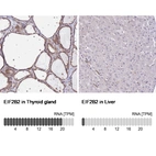 Anti-EIF2B2 Antibody