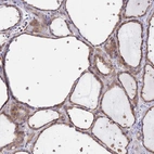 Immunohistochemical staining of human thyroid gland shows moderate cytoplasmic positivity in glandular cells.