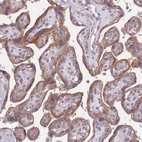 Immunohistochemical staining of human placenta shows moderate cytoplasmic positivity in trophoblastic cells.