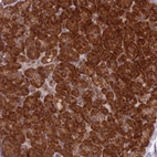 Immunohistochemical staining of human pancreas shows strong cytoplasmic positivity in exocrine glandular cells.