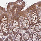 Immunohistochemical staining of human colon shows strong cytoplasmic positivity in glandular cells.