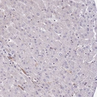Immunohistochemical staining of human liver shows no cytoplasmic positivity in hepatocytes as expected.