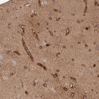 Immunohistochemical staining of human cerebral cortex shows moderate to strong membranous positivity in endothelial cells.