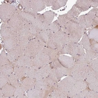 Immunohistochemical staining of human skeletal muscle shows no positivity in myocytes as expected.