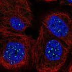 Anti-SIRPB2 Antibody