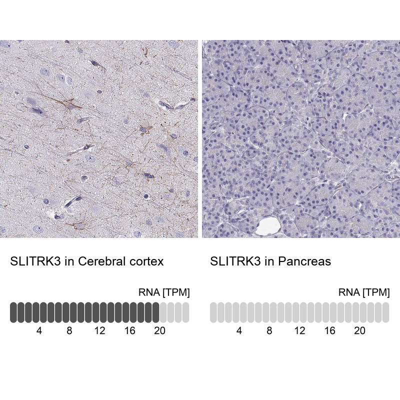 Anti-SLITRK3 Antibody