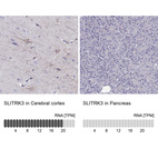 Anti-SLITRK3 Antibody