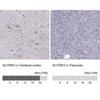 Anti-SLITRK3 Antibody