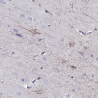 Immunohistochemical staining of human cerebral cortex shows high expression.
