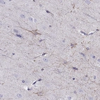 Immunohistochemical staining of human cerebral cortex shows high expression.