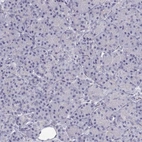 Immunohistochemical staining of human pancreas shows low expression as expected.