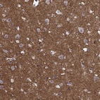 Immunohistochemical staining of human cerebral cortex shows high expression.