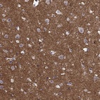 Anti-PRRT2 Antibody