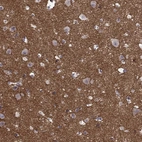 Immunohistochemical staining of human cerebral cortex shows high expression.