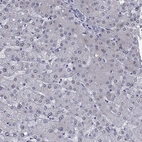 Immunohistochemical staining of human liver shows low expression as expected.