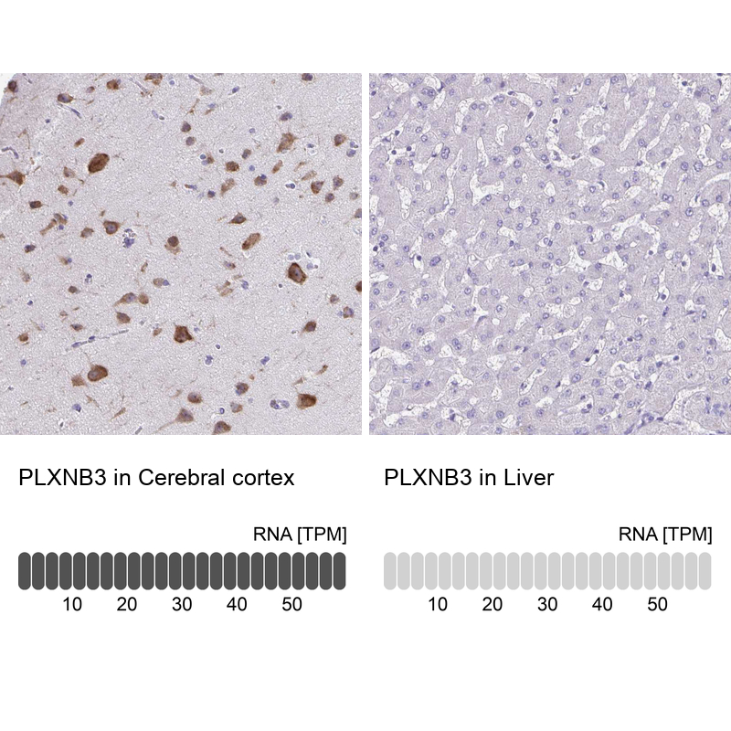 Anti-PLXNB3 Antibody