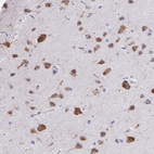 Anti-PLXNB3 Antibody