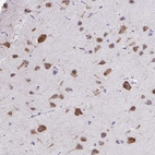 Immunohistochemical staining of human cerebral cortex shows strong cytoplasmic positivity in neurons.
