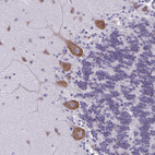 Immunohistochemical staining of human cerebellum shows moderate cytoplasmic positivity in Purkinje cells.