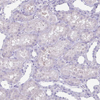 Immunohistochemical staining of human kidney shows no positivity in cells in tubules as expected.