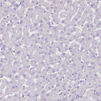 Anti-PLXNB3 Antibody