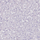 Immunohistochemical staining of human liver shows no positivity in hepatocytes as expected.