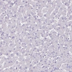 Immunohistochemical staining of human liver shows no positivity in hepatocytes as expected.