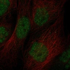 Immunofluorescent staining of human cell line EFO-21 shows localization to nucleoplasm.